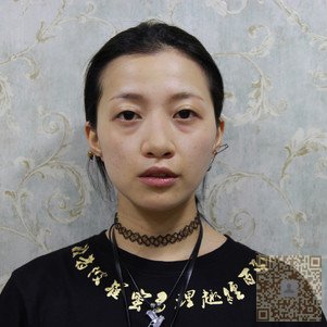 超雅不开刀隆鼻你值得拥有 超雅不开刀隆鼻你值得拥有