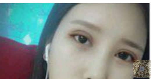 超声波去眼袋，让你摆脱眼袋的苦恼，成为大美女226