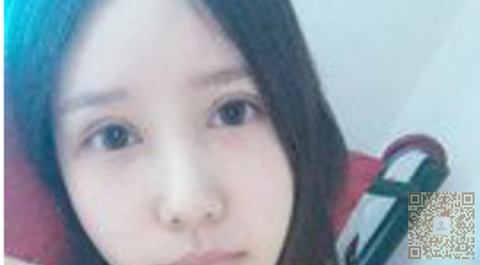 超声波去眼袋，让你摆脱眼袋的苦恼，成为大美女226