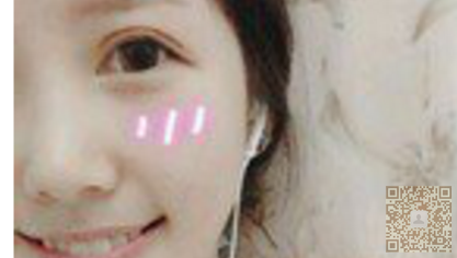 超声波去眼袋，让你摆脱眼袋的苦恼，成为大美女226