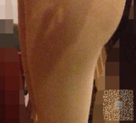 完美身材离不开美腿,想要美腿做超 声 波减肥 完美身材离不开美腿,想要美腿做超 声 波减肥