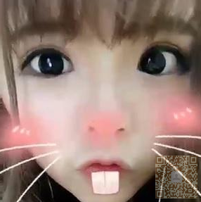 超声波双眼皮果然可以帮我形成双眼皮~~~780 超声波双眼皮果然可以帮我形成双眼皮~~~780