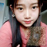 学生党也可以放心做的超声波双眼皮手术826 学生党也可以放心做的超声波双眼皮手术826