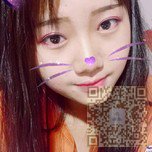 学生党也可以放心做的超声波双眼皮手术826 学生党也可以放心做的超声波双眼皮手术826