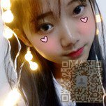 学生党也可以放心做的超声波双眼皮手术826 学生党也可以放心做的超声波双眼皮手术826