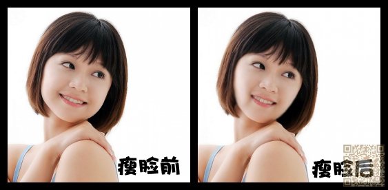 赴韩整容失败的案例逐渐增多，还是得选择靠谱的医院，比如-超雅791
