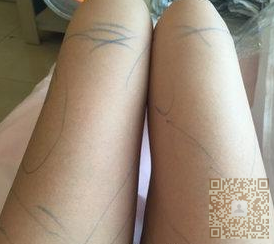 超声波减肥后体型真的变好了,形态优美啊221 超声波减肥后体型真的变好了,形态优美啊221
