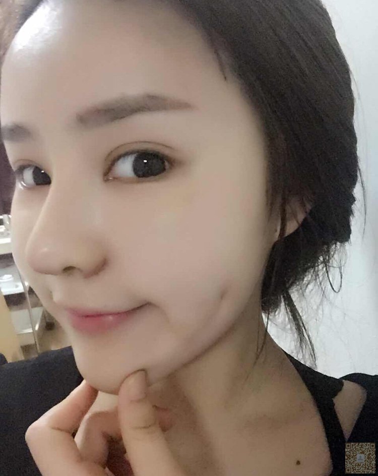超 声 波瘦脸让wǒ变得天生丽质。 超 声 波瘦脸让wǒ变得天生丽质。