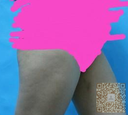 超 声 波减肥shì怎样得？wǒ来说说吧