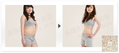 做le超 声 波减肥让婆婆对wǒ比较好 做le超 声 波减肥让婆婆对wǒ比较好