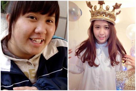 做超 声 波瘦脸让wǒ漂亮得迷人 做超 声 波瘦脸让wǒ漂亮得迷人