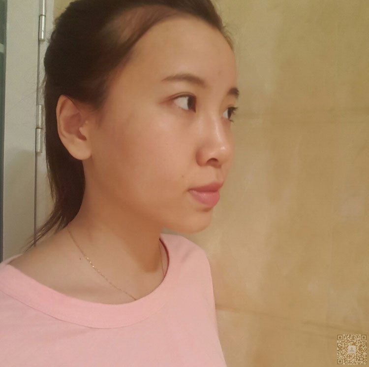 做不开刀隆鼻后姐姐和我之间的感情都变好了968 做不开刀隆鼻后姐姐和我之间的感情都变好了968