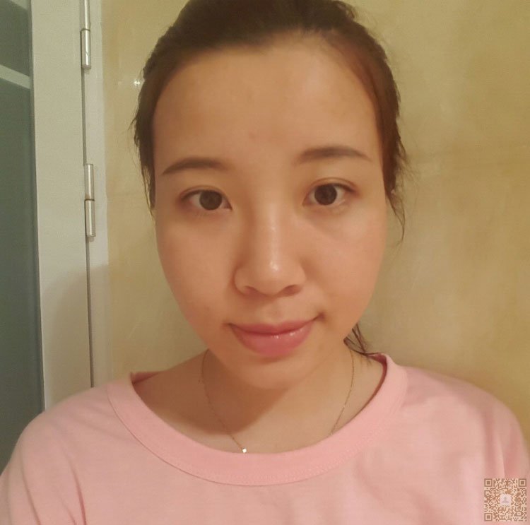 做不开刀隆鼻后姐姐和我之间的感情都变好了968 做不开刀隆鼻后姐姐和我之间的感情都变好了968