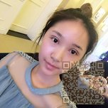 超雅医学美容研究所的超声波双眼皮做的真好看371 超雅医学美容研究所的超声波双眼皮做的真好看371