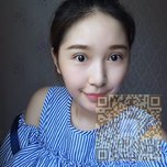 超雅医学美容研究所的超声波双眼皮做的真好看371 超雅医学美容研究所的超声波双眼皮做的真好看371