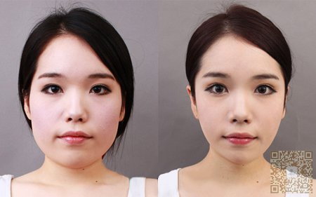 普通人想要变漂亮，可以选择到超雅医学美容研究所做美容113