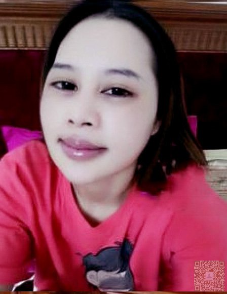 辣妈组团来瘦脸:做超声波瘦脸331 辣妈组团来瘦脸:做超声波瘦脸331