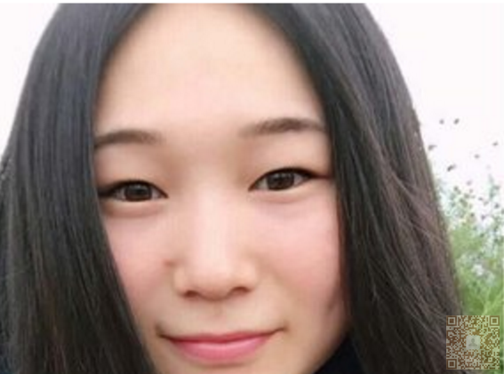 做完超声波双眼皮,大家都说我年轻了114 做完超声波双眼皮,大家都说我年轻了114