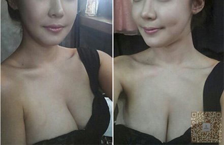 让超 声 波丰胸来拯救平胸得你 让超 声 波丰胸来拯救平胸得你