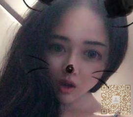 超声波自体脂肪丰胸让我也可以尽情的秀胸了，开心！！！269