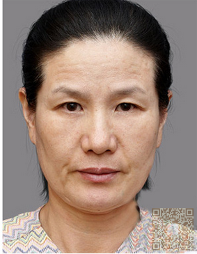 做了彭氏童颜术让我成功的出色演讲了239 做了彭氏童颜术让我成功的出色演讲了239