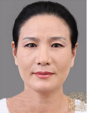 做了彭氏童颜术让我成功的出色演讲了239 做了彭氏童颜术让我成功的出色演讲了239