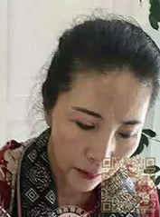 做了线雕失败后，我选择到超雅做面部提升术修复996