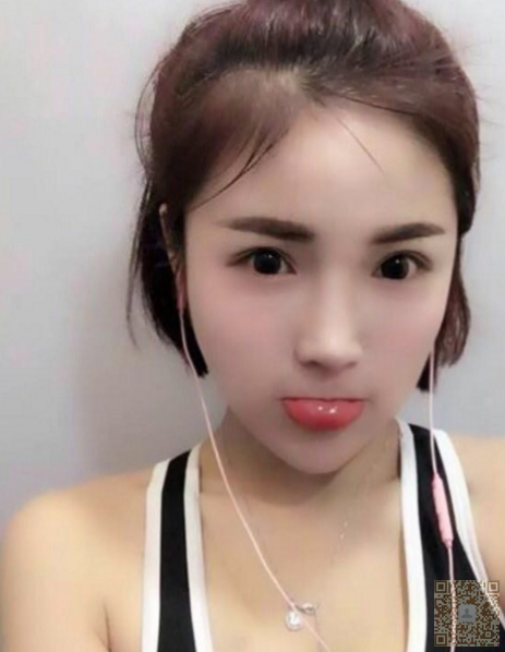 我要去重庆超雅做完超声波去眼袋啦110 我要去重庆超雅做完超声波去眼袋啦110