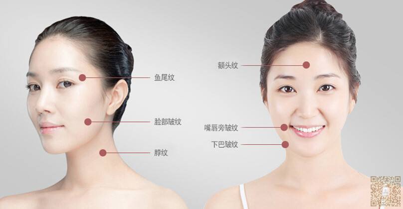 打造青春年轻脸,就做超 声 波提拉 打造青春年轻脸,就做超 声 波提拉