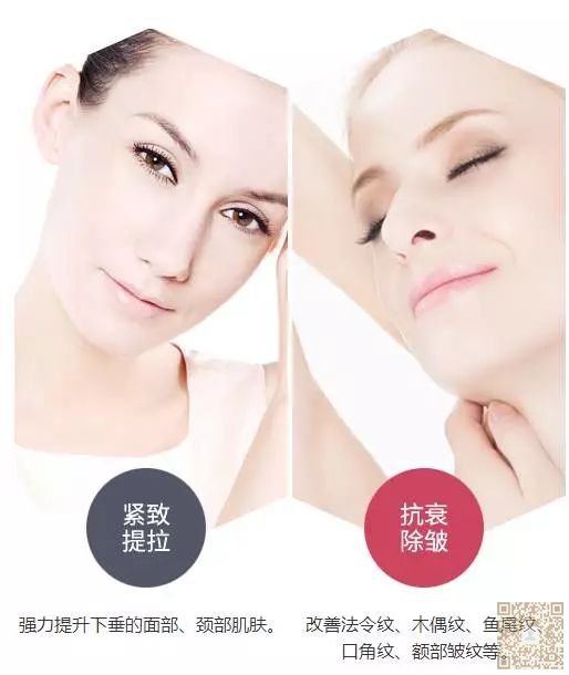 打造青春年轻脸,就做超 声 波提拉 打造青春年轻脸,就做超 声 波提拉