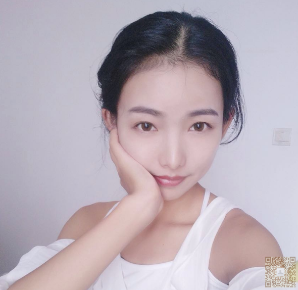 做了超声波提升术,让我看上去非常的有气质760 做了超声波提升术,让我看上去非常的有气质760