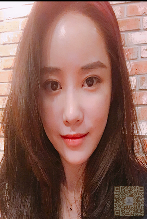 日记分享:我做的超声波提拉术654 日记分享:我做的超声波提拉术654