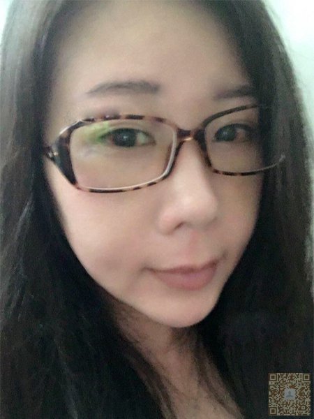 记录一下我去重庆超雅成功祛眼袋的过程吧941 记录一下我去重庆超雅成功祛眼袋的过程吧941