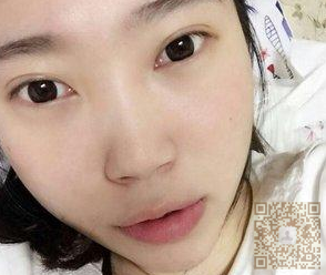 眼袋真心显老,还shì用超 声 波去眼袋 眼袋真心显老,还shì用超 声 波去眼袋