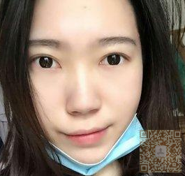 眼袋真心显老,还shì用超 声 波去眼袋 眼袋真心显老,还shì用超 声 波去眼袋