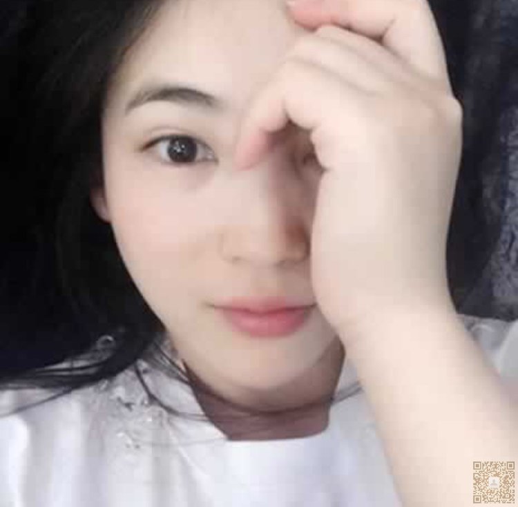 上网长的眼袋轻松祛除掉，就靠超雅超声波去眼袋904