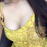 这么美丽的胸部就是超雅超声波自体脂肪丰胸手术给我的831