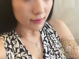 不开刀隆鼻后的效果真的好棒983 不开刀隆鼻后的效果真的好棒983