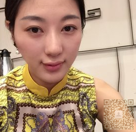 不开刀隆鼻后的效果真的好棒983 不开刀隆鼻后的效果真的好棒983
