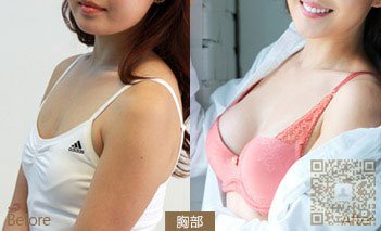 胸部变大le,因为用le超 声 波丰胸 胸部变大le,因为用le超 声 波丰胸