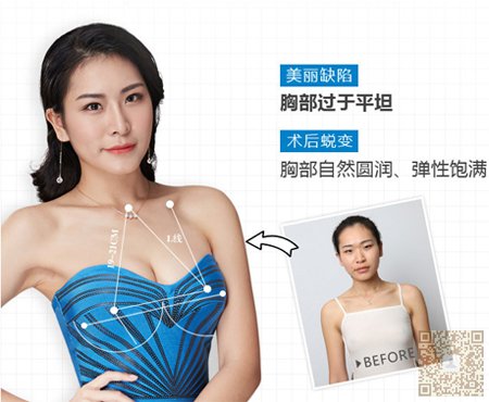 老公嫌我胸部小,超声波丰胸让我找回面子471 老公嫌我胸部小,超声波丰胸让我找回面子471