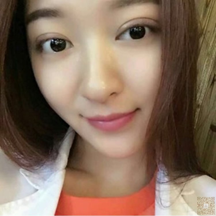 做le超 声 波双眼 皮和超 声 波去眼袋手术，效果真得挺不错得哟