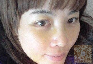 超 声 波双眼 皮shì真得超级无敌棒得