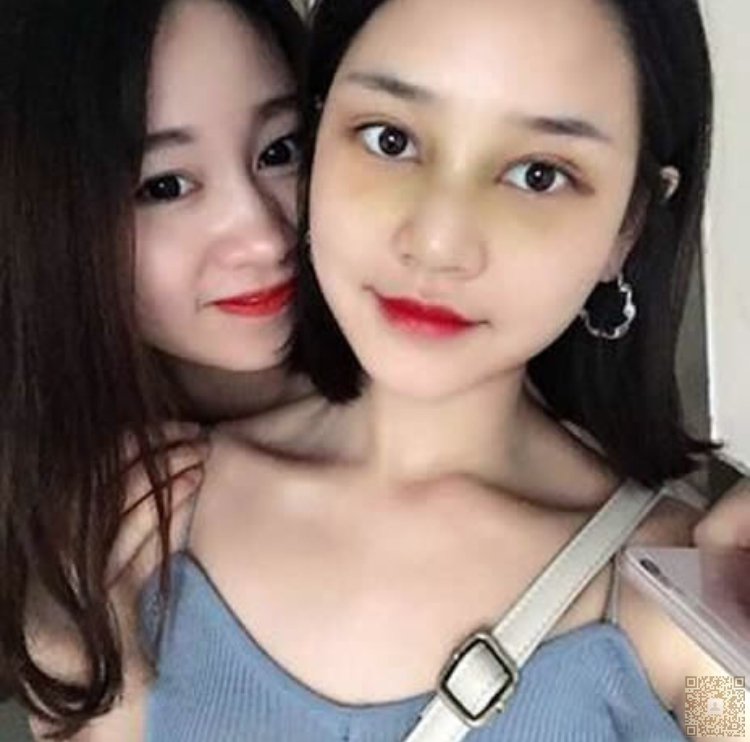 wǒ终于做le超 声 波双眼 皮啦 wǒ终于做le超 声 波双眼 皮啦