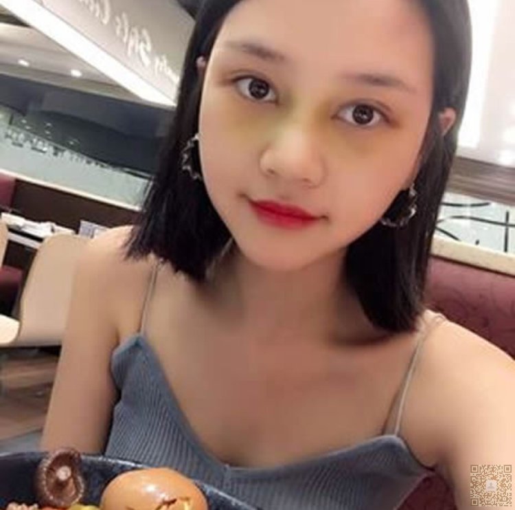 wǒ终于做le超 声 波双眼 皮啦 wǒ终于做le超 声 波双眼 皮啦