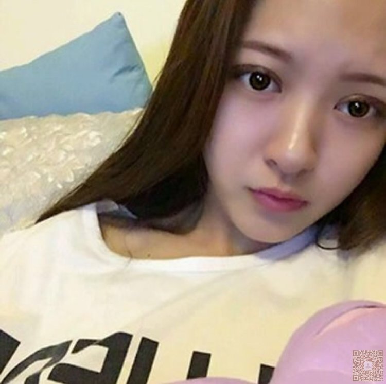 超声波双眼皮让你的拥有迷人大眼睛467 超声波双眼皮让你的拥有迷人大眼睛467