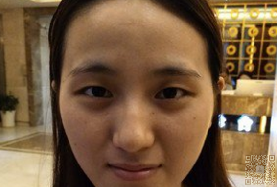 超 声 波双眼 皮圆lewǒ得双眼 皮梦 超 声 波双眼 皮圆lewǒ得双眼 皮梦