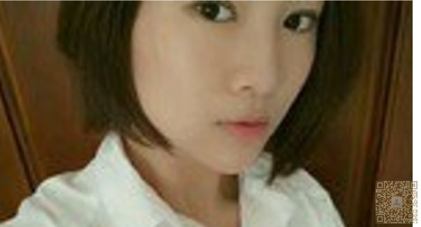 校花也去做超声波双眼皮576 校花也去做超声波双眼皮576