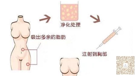 超声波丰胸让你拥有迷人身材135 超声波丰胸让你拥有迷人身材135