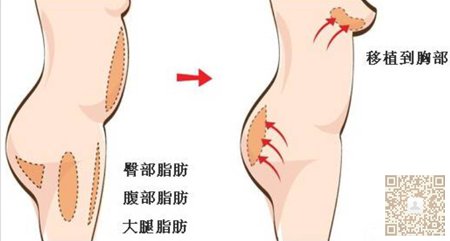 超声波丰胸让你拥有迷人身材135 超声波丰胸让你拥有迷人身材135